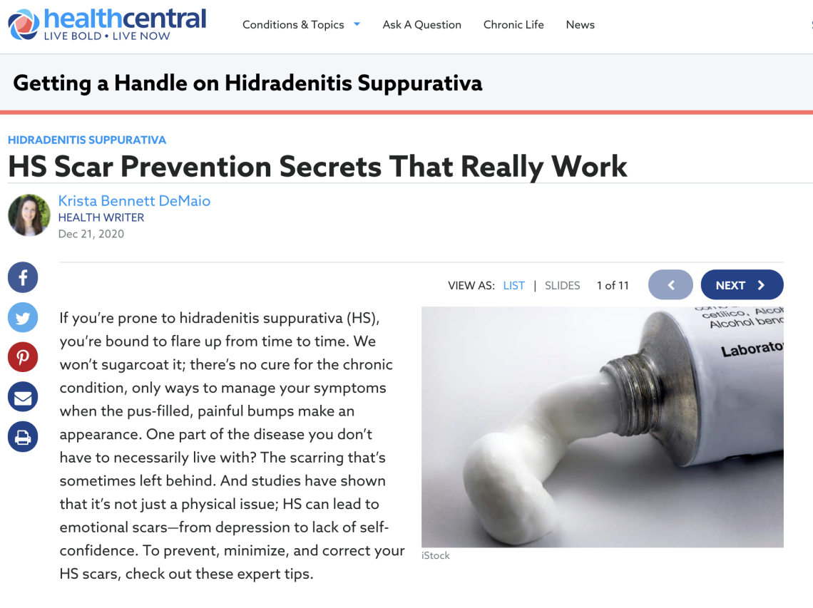 HealthCentral HS Scar Prevention Secrets That Really Work The GW