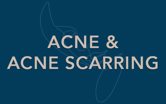 acne & acne scarring