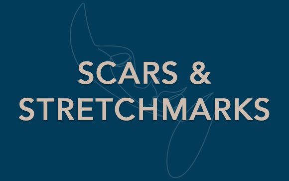 scars and stretchmarks