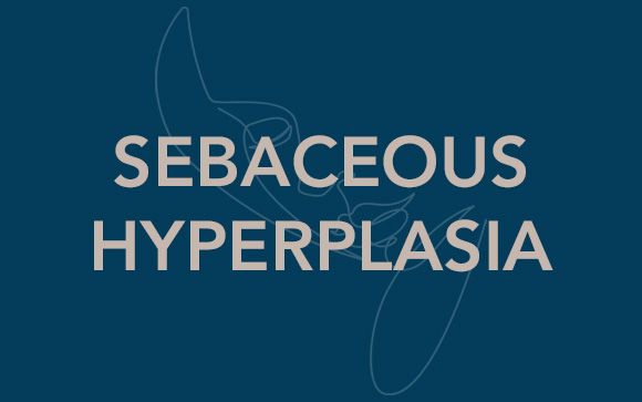 Sebaceous Hyperplasia