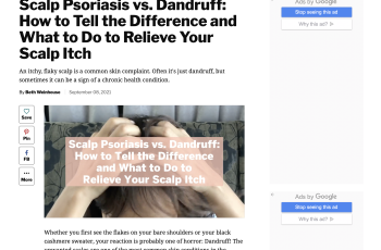 Scalp Psoriasis vs. Dandruff: How to Tell the Difference and What to Do to Relieve Your Scalp Itch